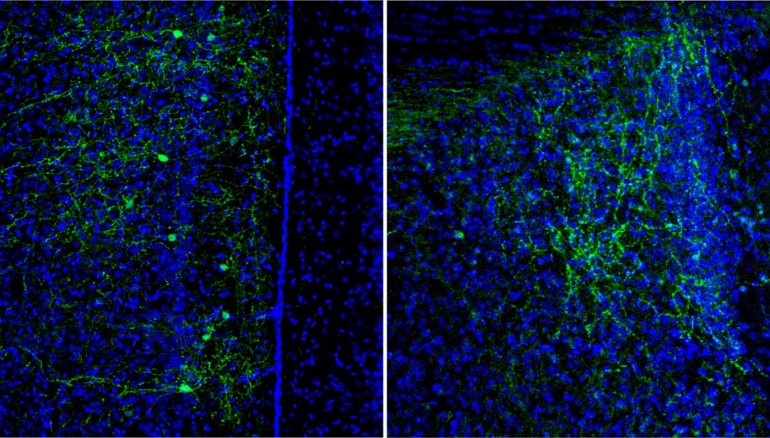 Neuronas CRH+ en la corteza prefrontal de un ratón (izquierda) y axones de dichas neuronas en la región del septum lateral (derecha). Crédito: Instituto de Neurociencias. --
