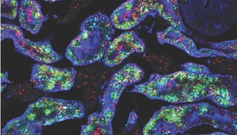 Dos de los genes -Gsta4 en rojo y Cyp4a14 en verde- que son más activos en los riñones de ratones hembra (azul) / Crédito: Jing Liu/Laboratorio McMahon.